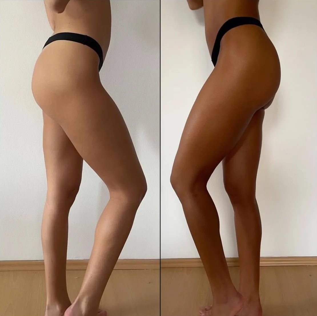 Înainte și după bronzarea organică cu DHA la Cellulite Expert